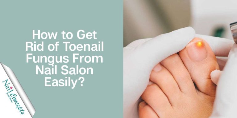 Read to Know How to get rid of toenail fungus from nail salon?
