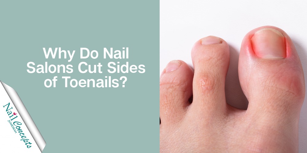 Why Do Nail Salons Cut Sides of Toenails