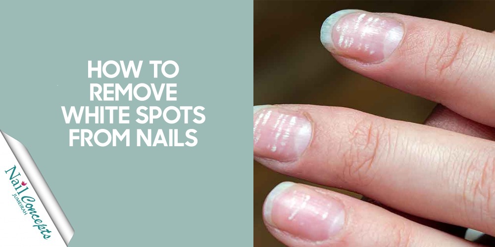 How to Remove White Spots from Nails